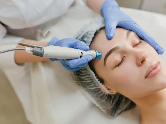 Hydrafacial for Acne-Prone Skin: A New Hope for Clear Complexions